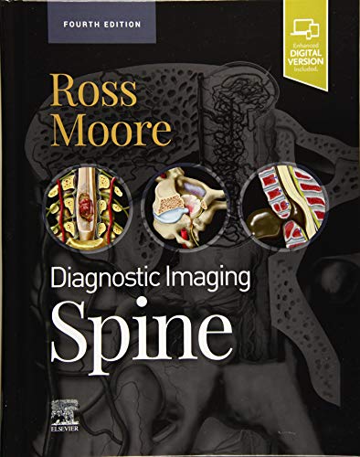 Diagnostic Imaging: Spine von Elsevier
